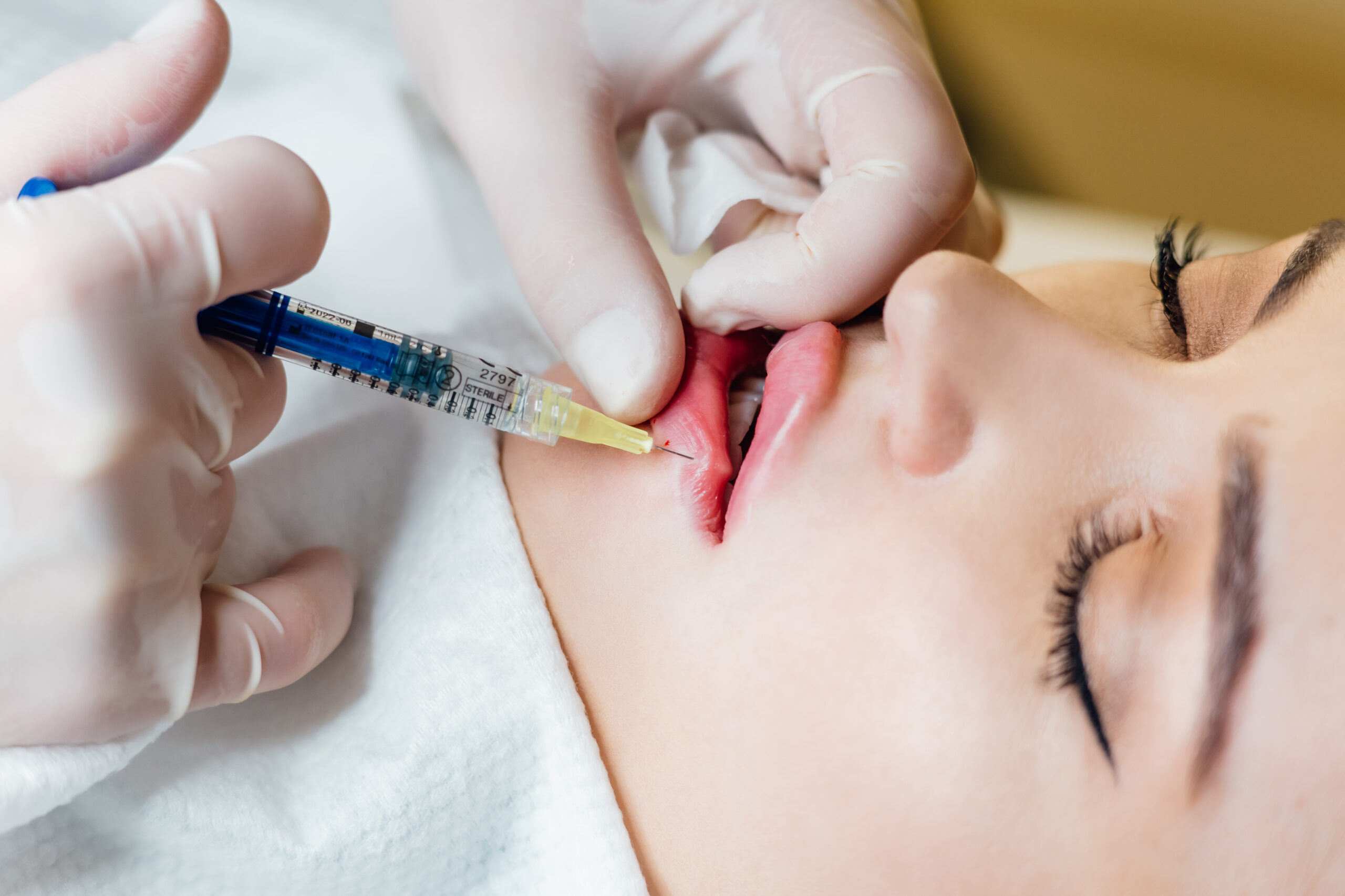 Close up of hands of cosmetologist making injection in female lips