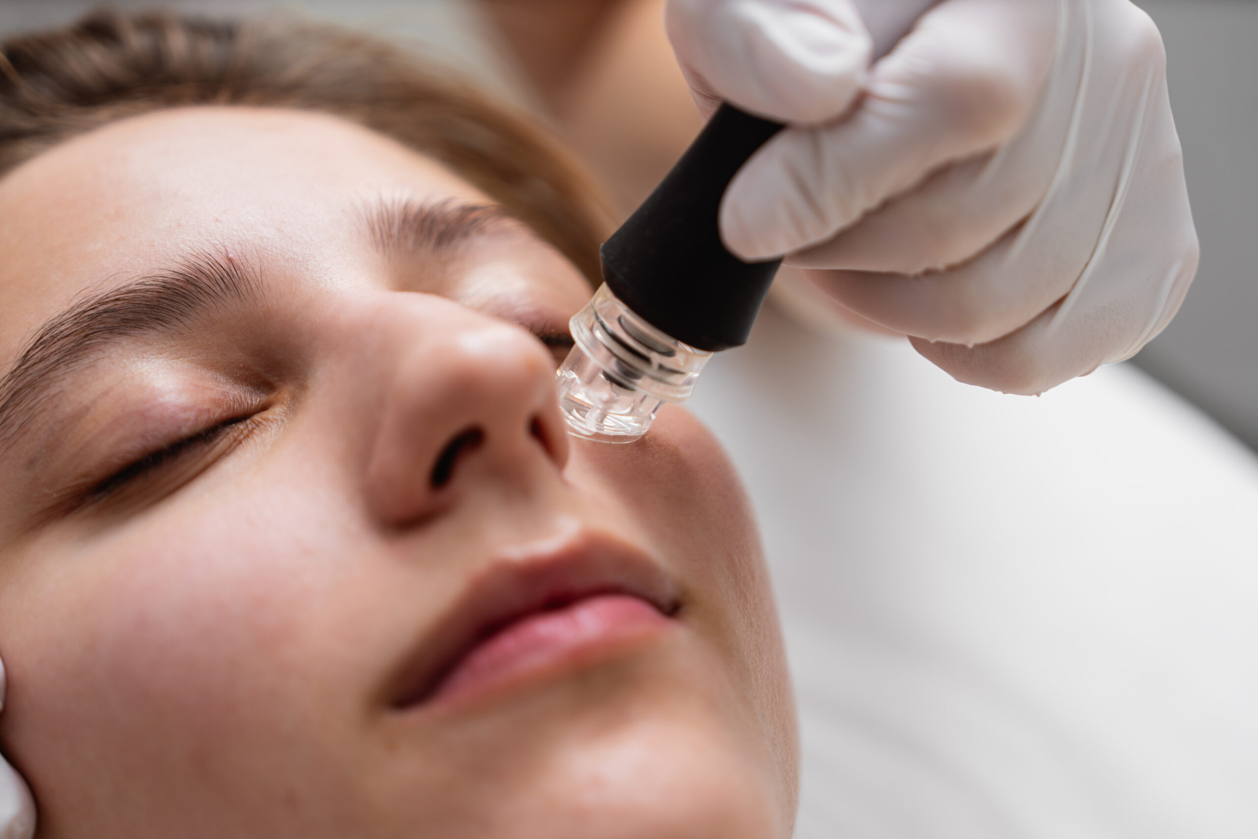 A cosmetologist performs hydropiling in a beauty salon. Skin care.