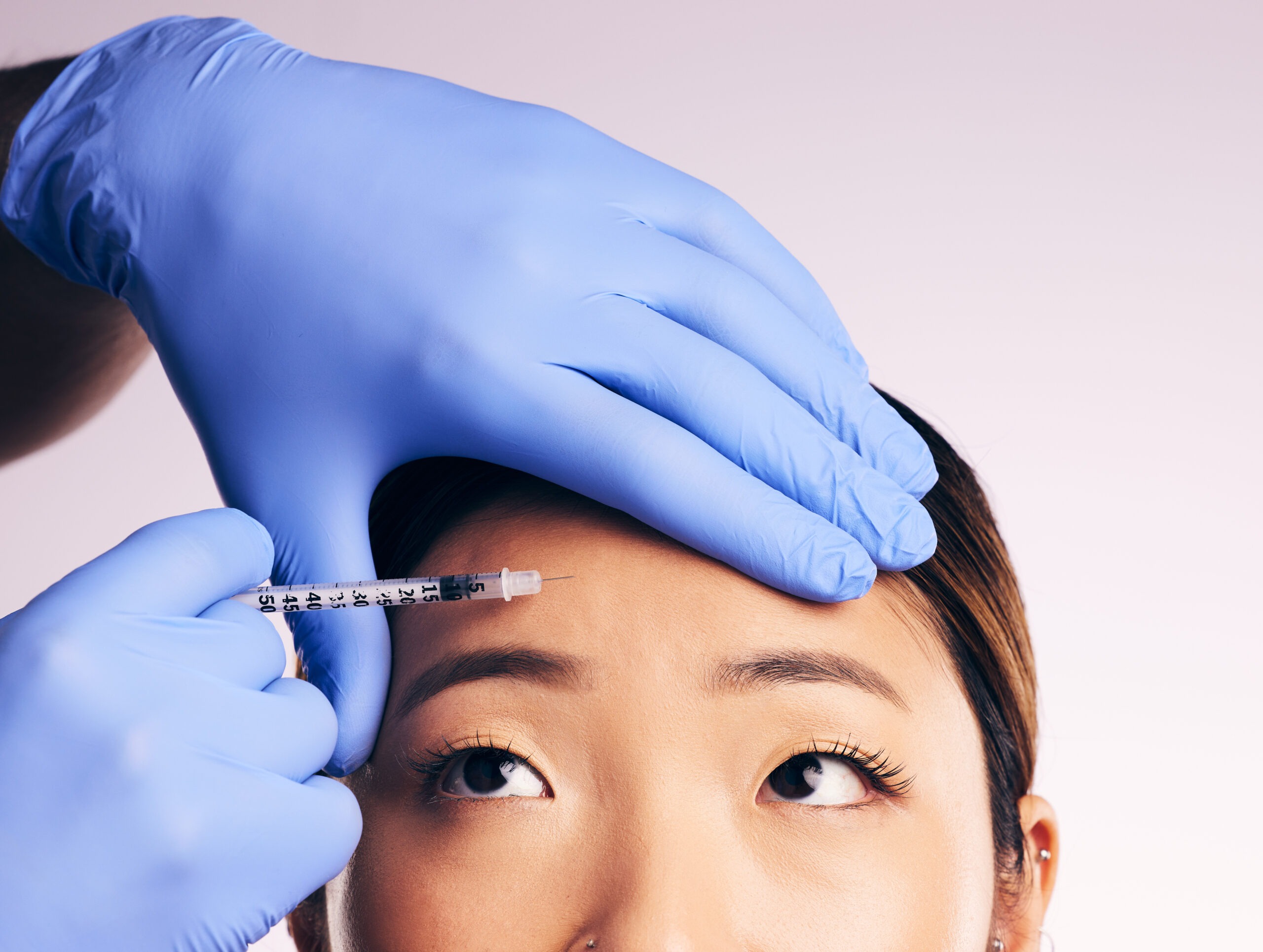 wrinkle-injections-picture-1
